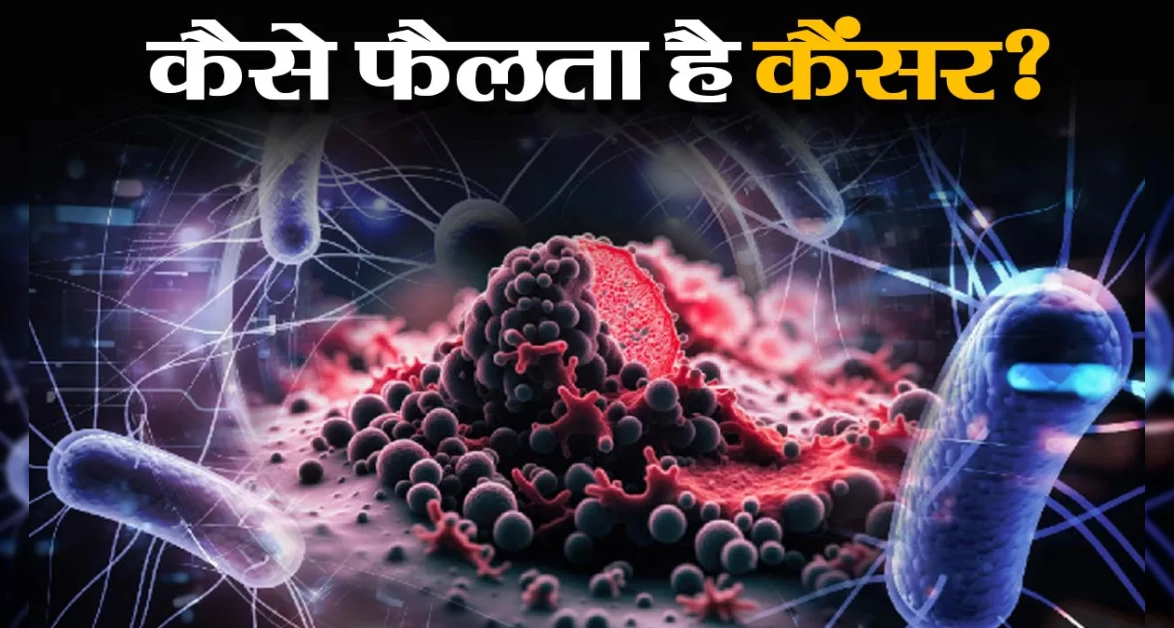 कैंसर के खिलाफ नई लड़ाई: जब संक्रमण ही बन जाए जानलेवा बीमारी